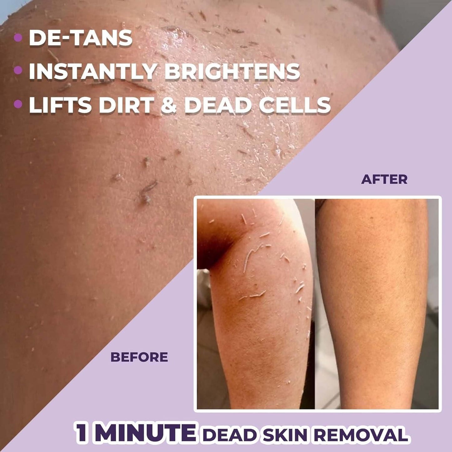 Instant Tan & Dead Skin Removal Exfoliating Gel 100 gm (Pack of 2)